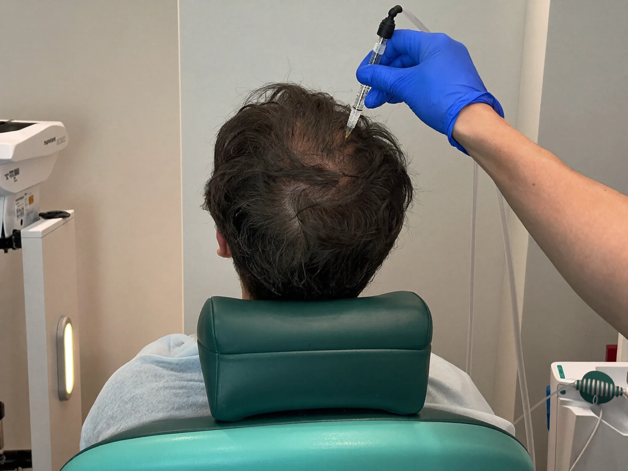 Mesotherapie bei Haarausfall