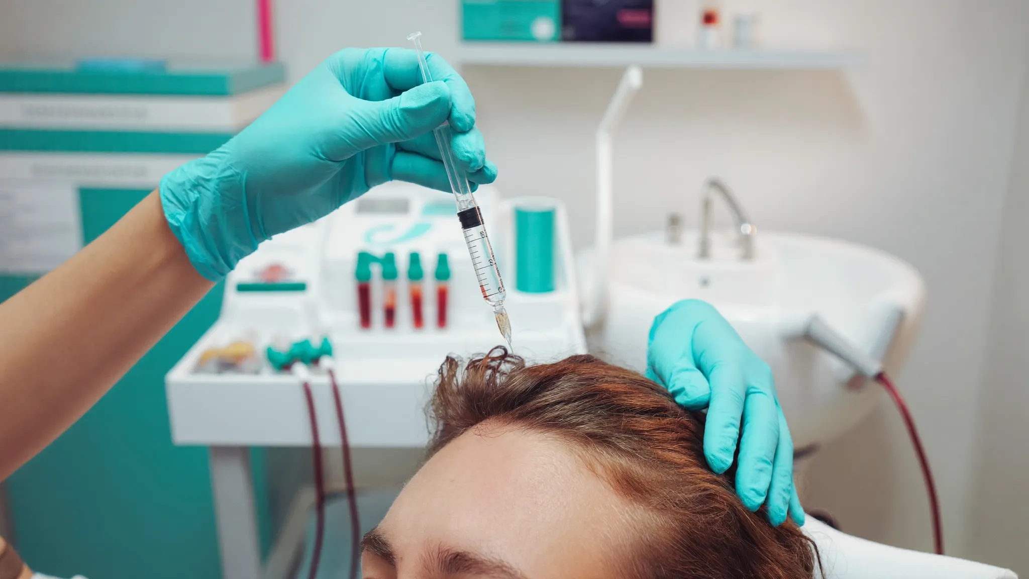 PRP Behandlung gegen Haarausfall