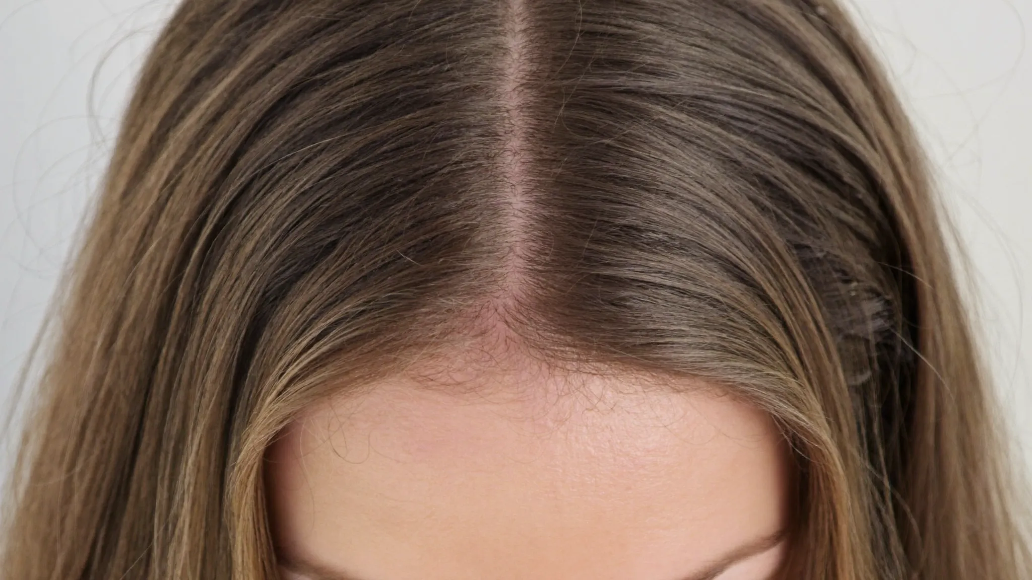 Polynukleotide bei Haarausfall